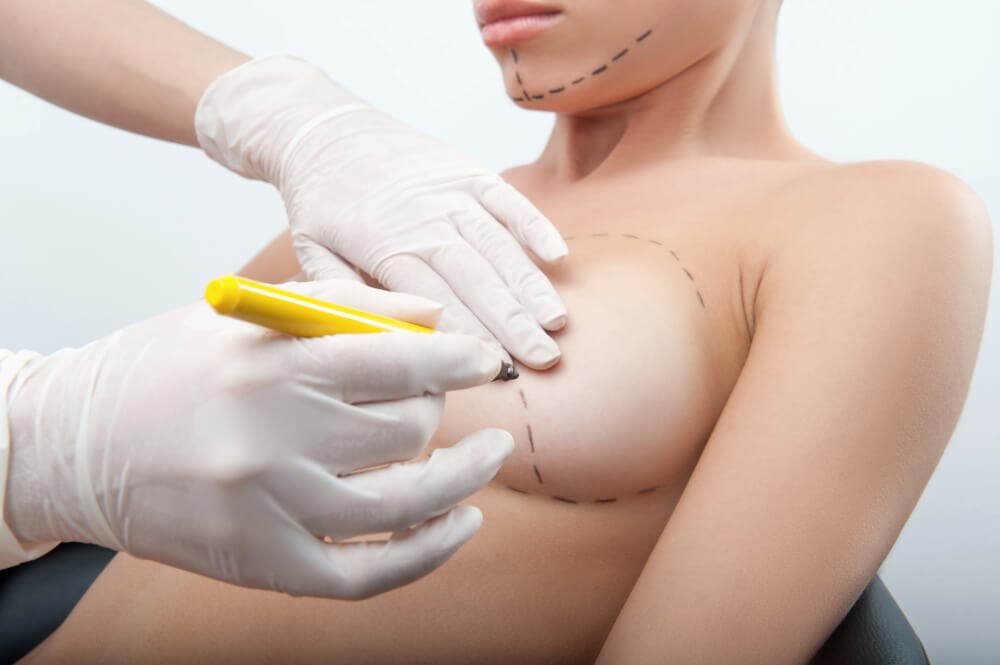 Plastic Surgery in Beverly Hills, CA