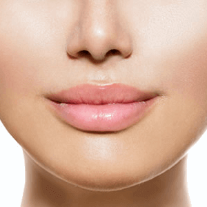 Lip Augmentation in Beverly Hills, CA