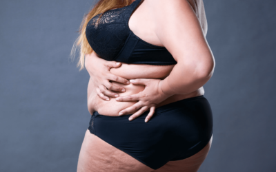 Five Benefits of Extreme Weight Loss Surgery and Removing Excess Skin
