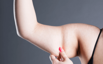 Will Liposuction On The Arms Also Get Rid Of Loose Skin?