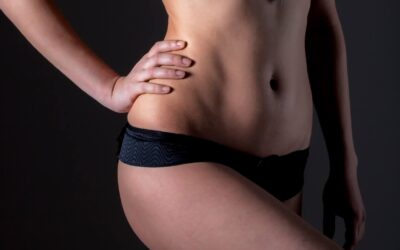 Who Is The Ideal Candidate For Liposuction?